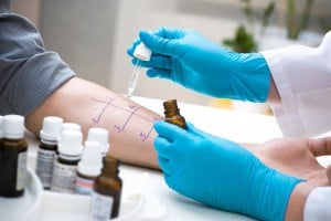 Allergy Testing - Skin Prick Testing
